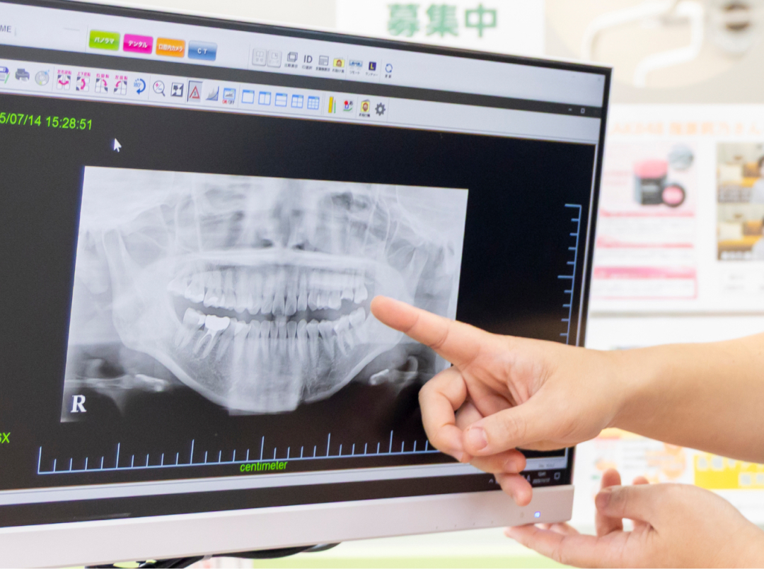 歯の黄ばみが気になる！