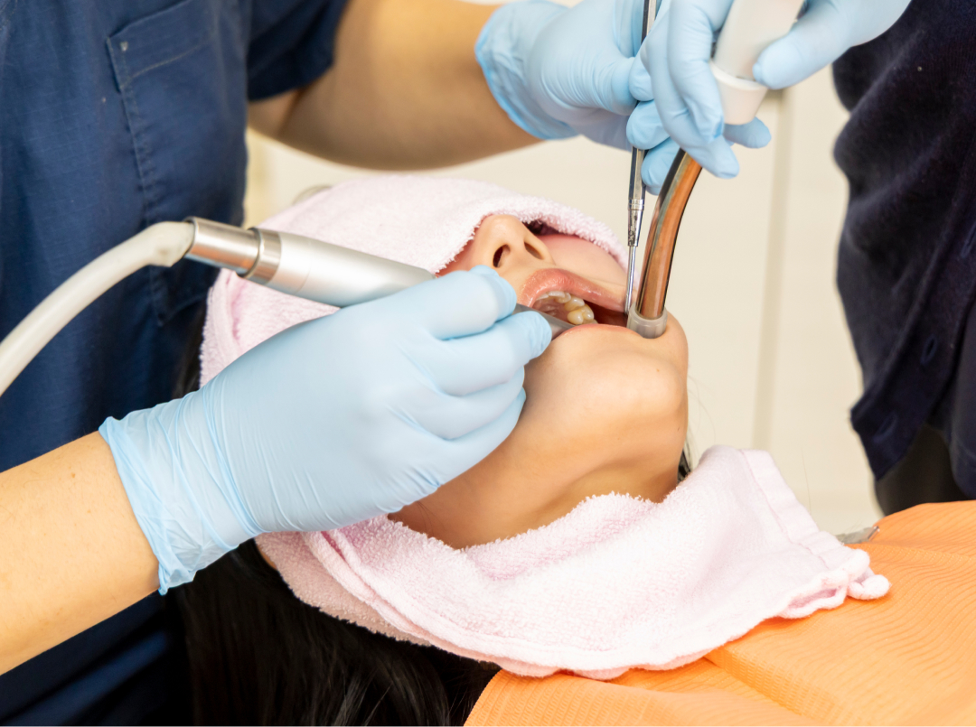 歯の黄ばみが気になる！